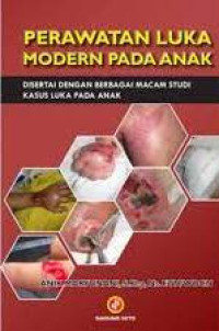 Image of Perawatan Luka Modern Pada Anak